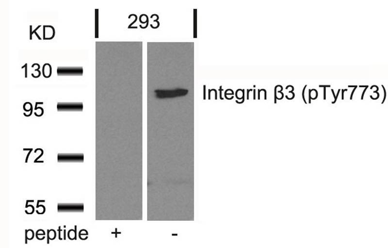 Polyclonal Antibody to Integrin beta3 (Phospho-Tyr773)