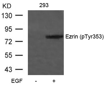 Polyclonal Antibody to Ezrin (Phospho-Tyr353)