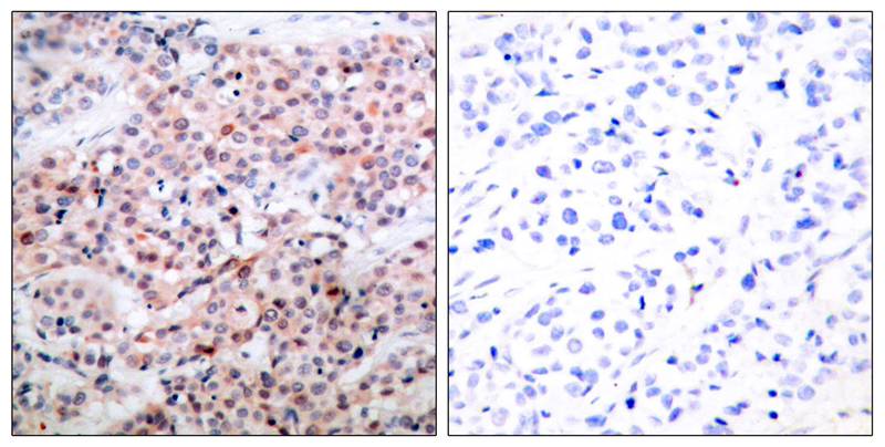 Polyclonal Antibody to BCL-2(Phospho-Thr56)