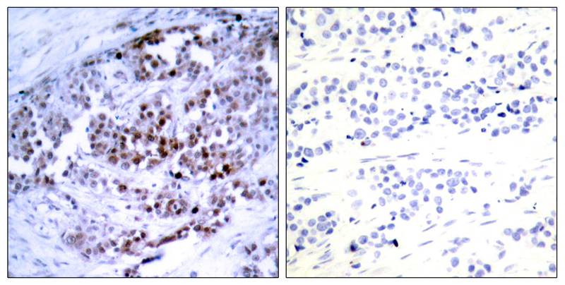 Polyclonal Antibody to BCL-2(Phospho-Ser70)