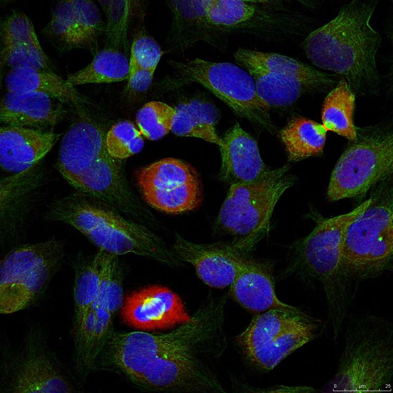 Polyclonal Antibody to BCL-XL(Phospho-Ser62)