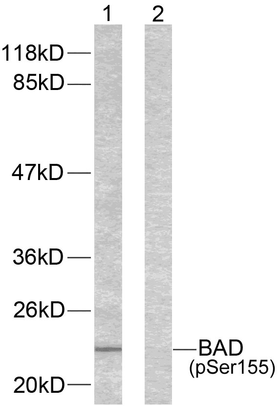 Polyclonal Antibody to BAD(Phospho-Ser155)