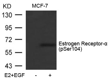 Polyclonal Antibody to Estrogen Receptor- Alpha (Phospho-Ser104)