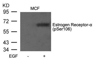 Polyclonal Antibody to Estrogen Receptor- Alpha (Phospho-Ser106)