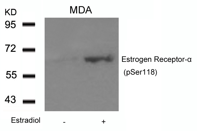 Polyclonal Antibody to Estrogen Receptor- Alpha (Phospho-Ser118)