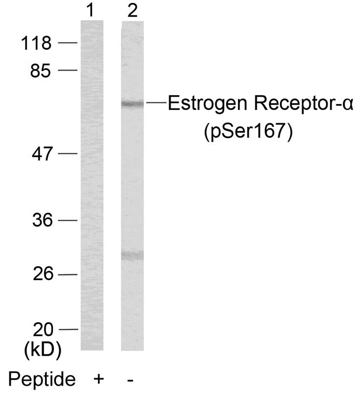 Polyclonal Antibody to Estrogen Receptor- Alpha (Phospho-Ser167)