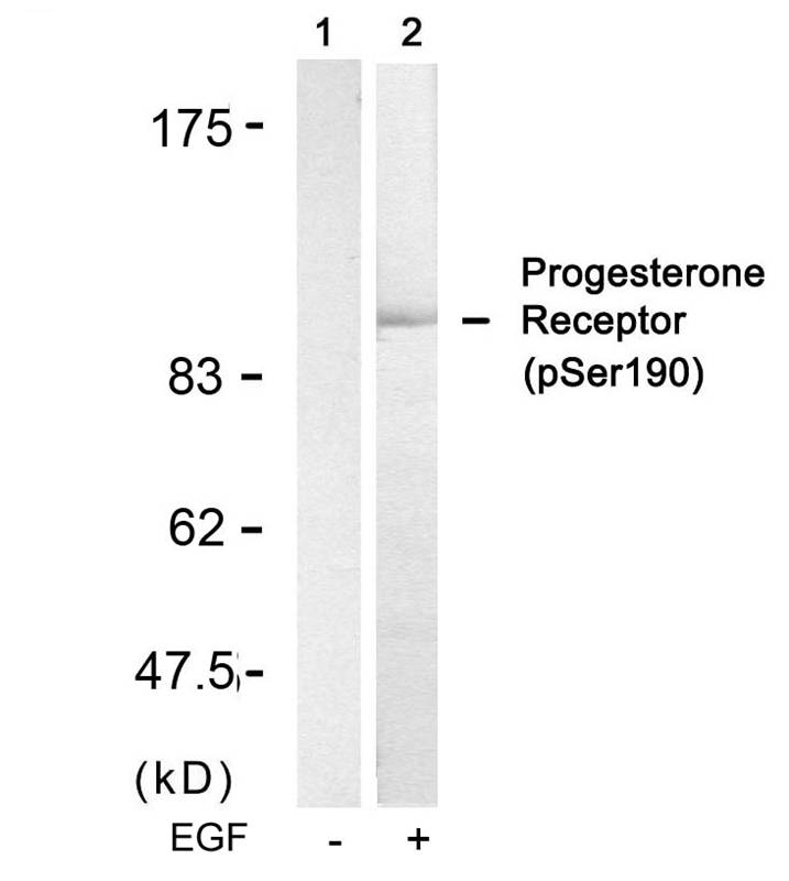 Polyclonal Antibody to Progesterone Receptor (Phospho-Ser190)