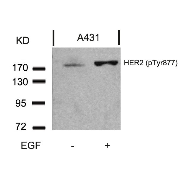 Polyclonal Antibody to HER2 (Phospho-Tyr877)