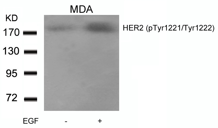 Polyclonal Antibody to HER2 (Phospho-Tyr1221/Tyr1222)