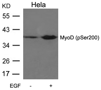 Polyclonal Antibody to MyoD (Phospho-Ser200)