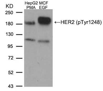 Polyclonal Antibody to HER2 (Phospho-Tyr1248)