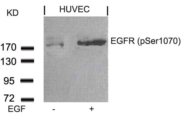 Polyclonal Antibody to EGFR (Phospho-Ser1070)