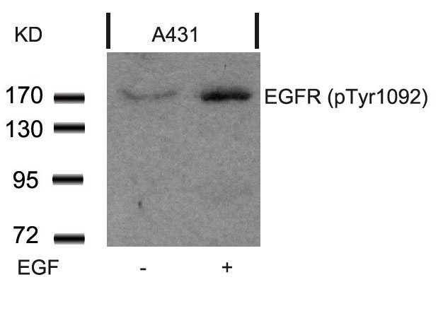 Polyclonal Antibody to EGFR (Phospho-Tyr1092)