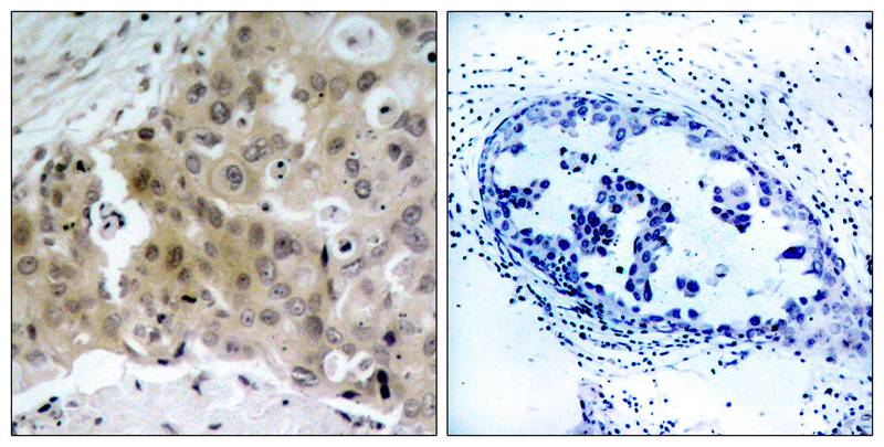 Polyclonal Antibody to VEGFR2 (Phospho-Tyr1175)