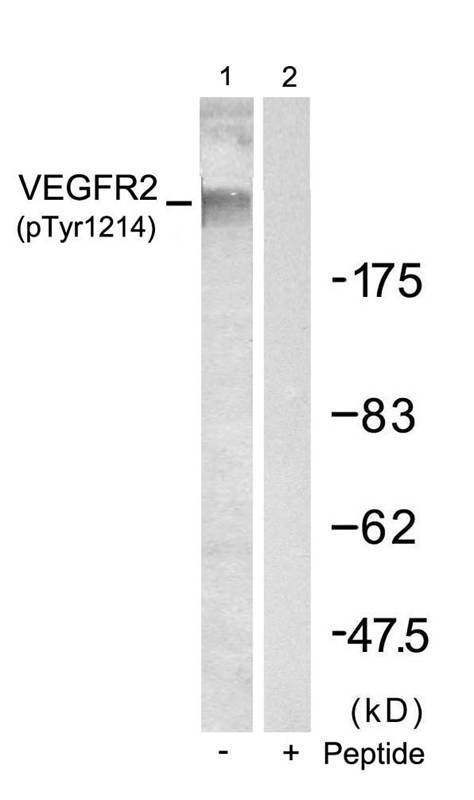 Polyclonal Antibody to VEGFR2 (Phospho-Tyr1214)