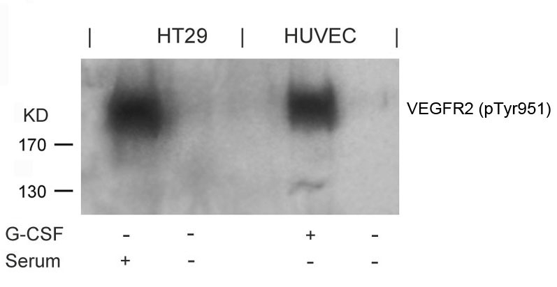 Polyclonal Antibody to VEGFR2 (Phospho-Tyr951)