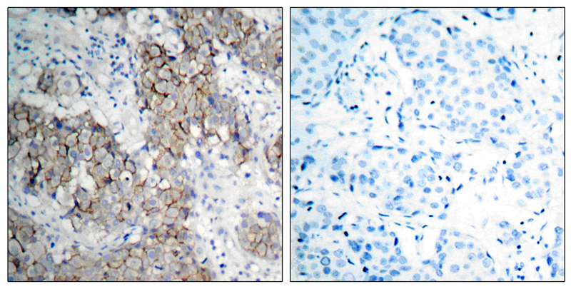 Polyclonal Antibody to IGF-1R(Phospho-Tyr1161)