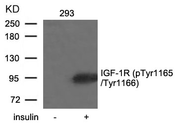 Polyclonal Antibody to IGF-1R (Phospho-Tyr1165/Tyr1166)