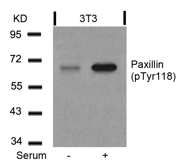 Polyclonal Antibody to Paxillin (Phospho-Tyr118)