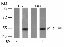 Polyclonal Antibody to p53 (Phospho-Ser6)