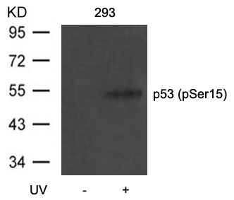 Polyclonal Antibody to p53 (Phospho-Ser15)