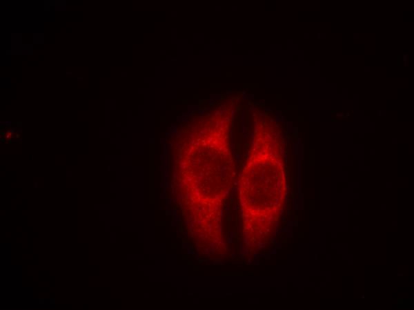 Polyclonal Antibody to p53 (Phospho-Ser37)