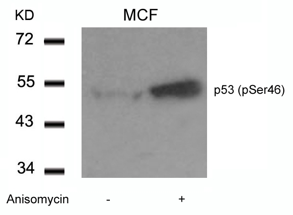 Polyclonal Antibody to p53 (Phospho-Ser46)