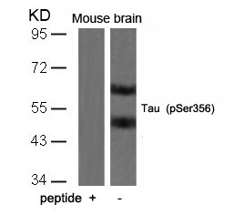 Polyclonal Antibody to Tau (Phospho-Ser356)