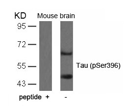 Polyclonal Antibody to Tau (Phospho-Ser396)