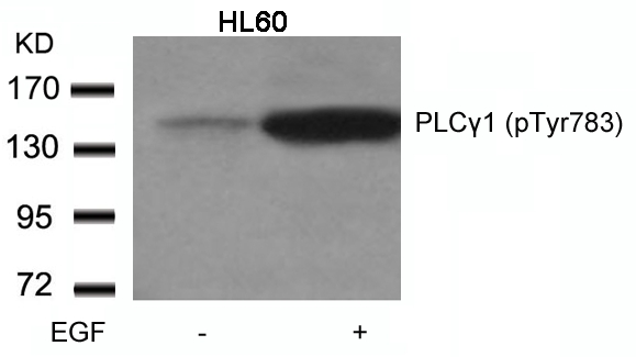 Polyclonal Antibody to PLC Gamma1 (Phospho-Tyr783)