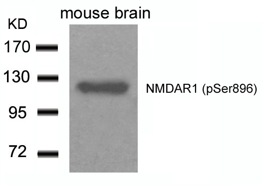 Polyclonal Antibody to NMDAR1 (Phospho-Ser896)