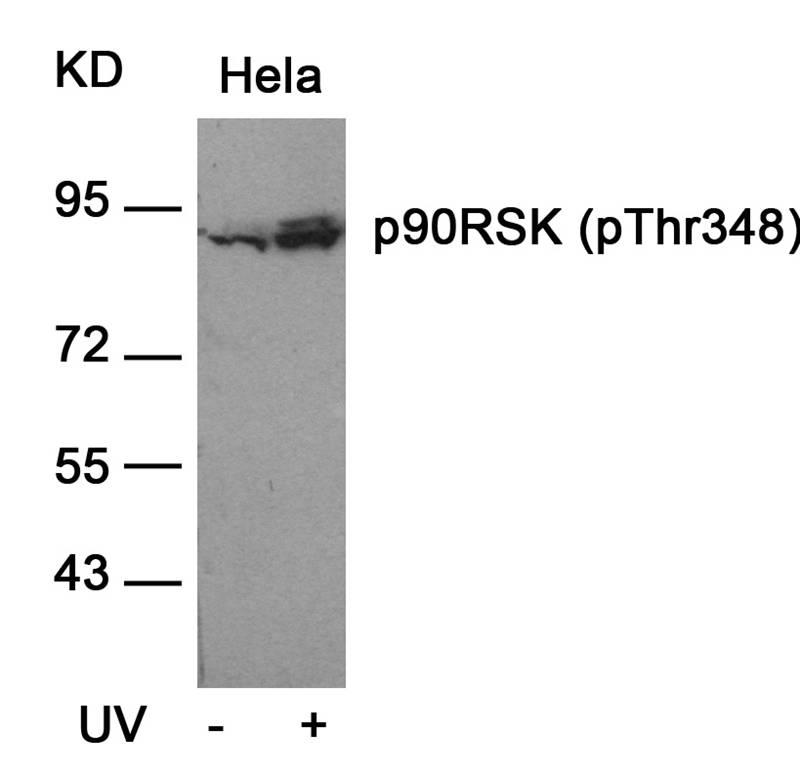 Polyclonal Antibody to p90RSK (Phospho-Thr348)