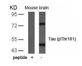 Polyclonal Antibody to Tau (Phospho-Thr181)