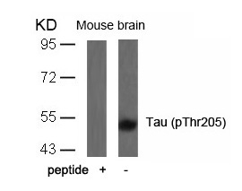 Polyclonal Antibody to Tau (Phospho-Thr205)