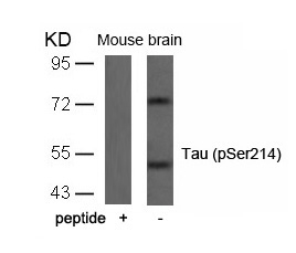 Polyclonal Antibody to Tau (Phospho-Ser214)