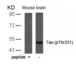 Polyclonal Antibody to Tau (Phospho-Thr231)