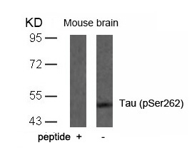 Polyclonal Antibody to Tau (Phospho-Ser262)