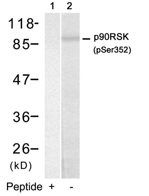 Polyclonal Antibody to p90RSK (Phospho-Ser352)