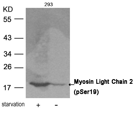 Polyclonal Antibody to Myosin Light Chain 2 (Phospho-Ser19)