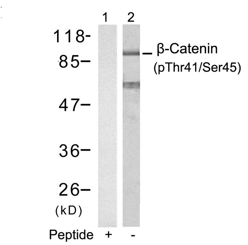 Polyclonal Antibody to beta-Catenin (Phospho-Thr41/Ser45)