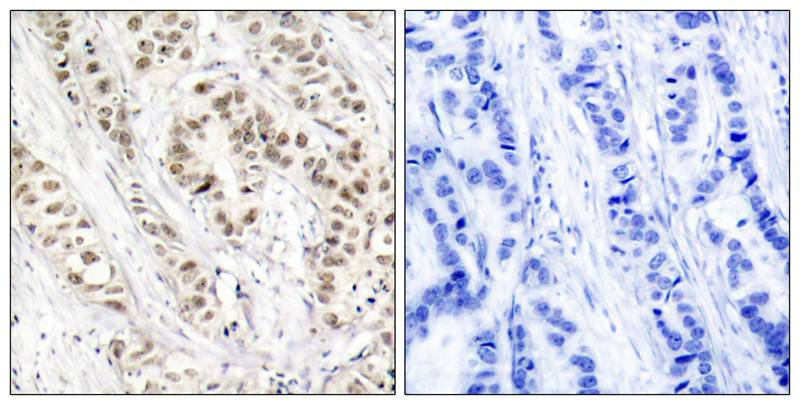 Polyclonal Antibody to BRCA1 (Phospho-Ser1524)