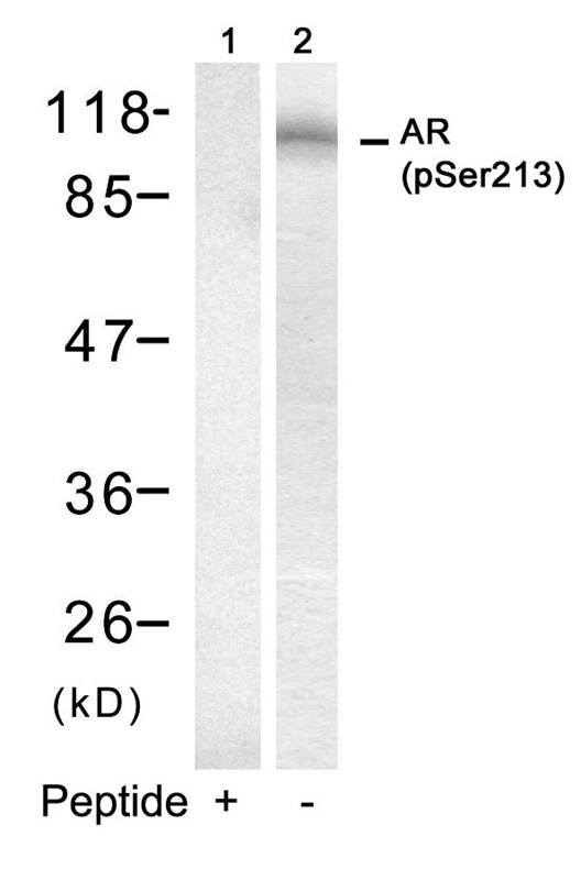 Polyclonal Antibody to Androgen Receptor (Phospho-Ser213)