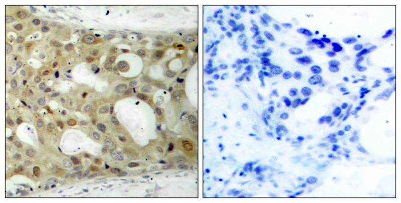 Polyclonal Antibody to Androgen Receptor (Phospho-Ser650)