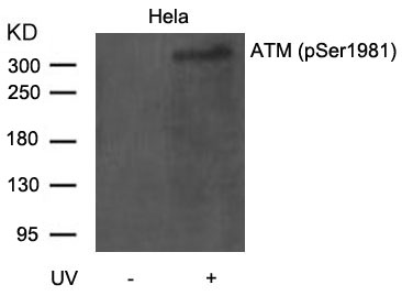 Polyclonal Antibody to ATM (Phospho-Ser1981)