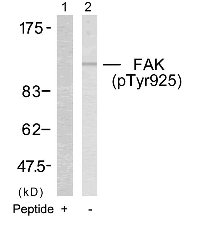 Polyclonal Antibody to FAK (Phospho-Tyr925)