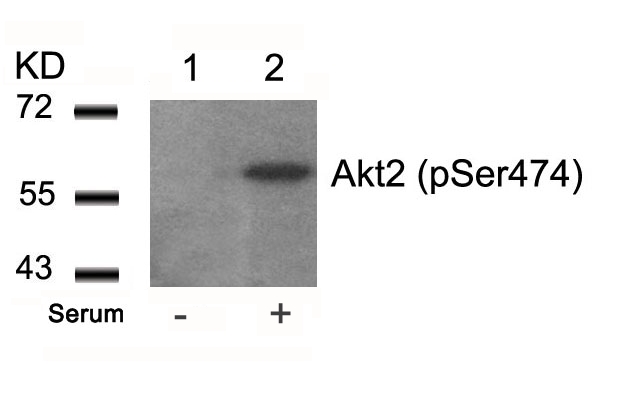 Polyclonal Antibody to Akt2 (Phospho-Ser474)