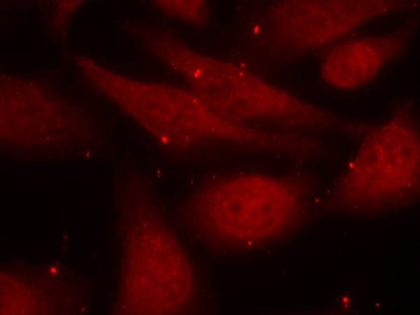 Polyclonal Antibody to c-Abl(Phospho-Tyr412)