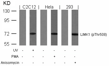 Polyclonal Antibody to LIMK1 (Phospho-Thr508)