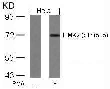 Polyclonal Antibody to LIMK2 (Phospho-Thr505)