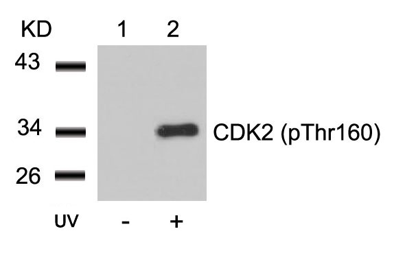 Polyclonal Antibody to CDK2 (Phospho-Thr160)